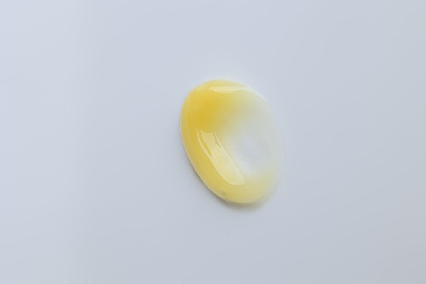 Vitamin A Serum Level 1 (Login Required)