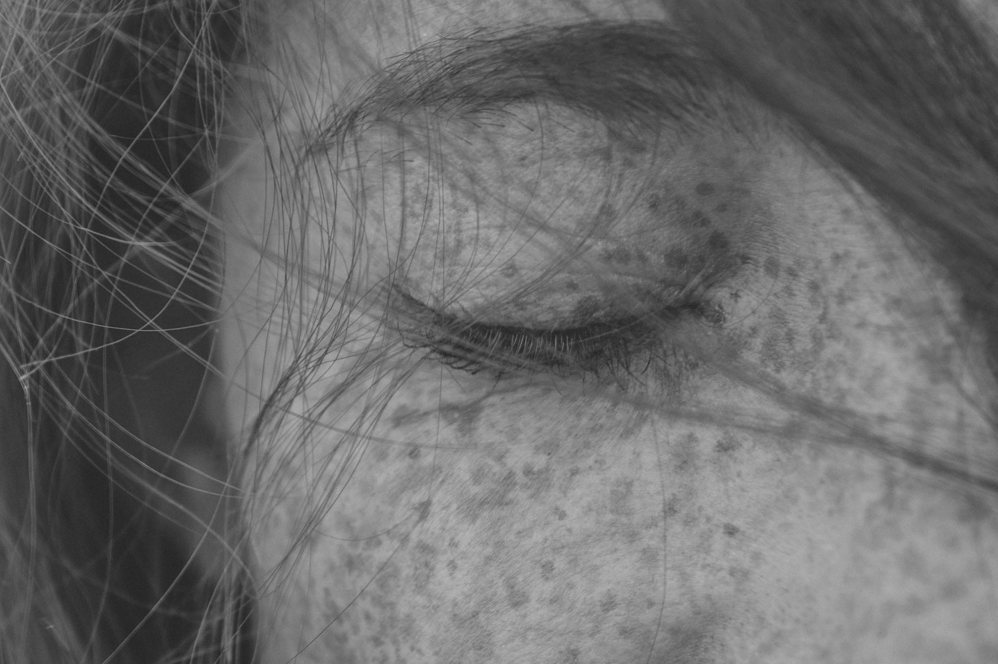 Pigmentation